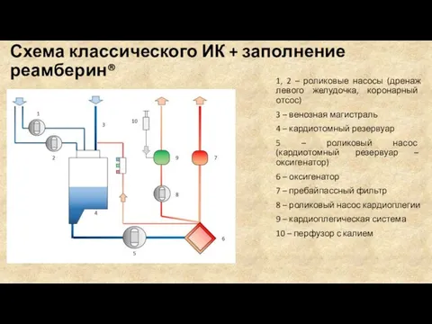 Схема классического ИК + заполнение реамберин® 1, 2 – роликовые насосы