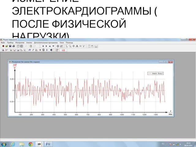 ИЗМЕРЕНИЕ ЭЛЕКТРОКАРДИОГРАММЫ ( ПОСЛЕ ФИЗИЧЕСКОЙ НАГРУЗКИ)