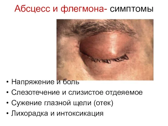 Абсцесс и флегмона- симптомы Напряжение и боль Слезотечение и слизистое отдеяемое