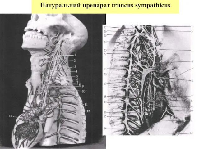 Натуральний препарат truncus sympathicus