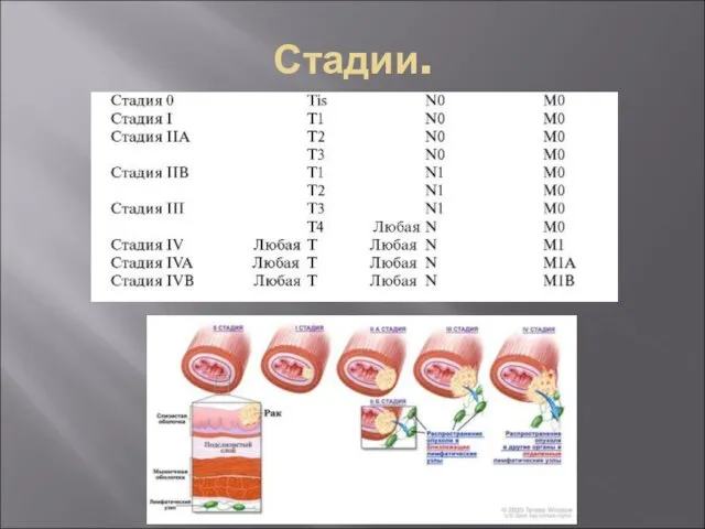 Стадии.