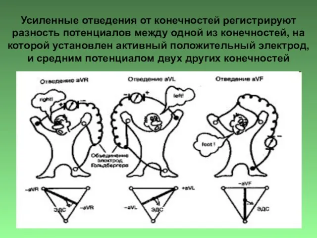 Усиленные отведения от конечностей регистрируют разность потенциалов между одной из конечностей,