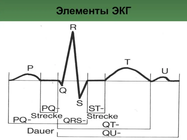 Элементы ЭКГ