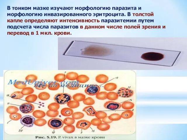 В тонком мазке изучают морфологию паразита и морфологию инвазированного эритроцита. В