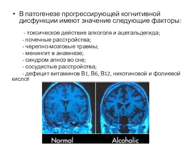 В патогенезе прогрессирующей когнитивной дисфункции имеют значение следующие факторы: - токсическое