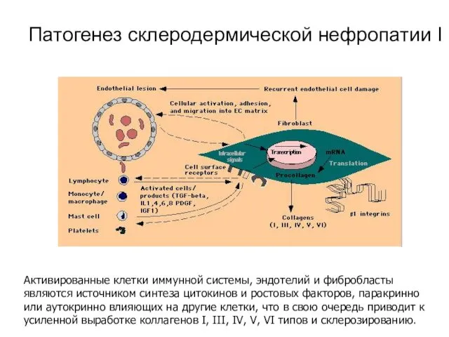 Патогенез склеродермической нефропатии I Активированные клетки иммунной системы, эндотелий и фибробласты