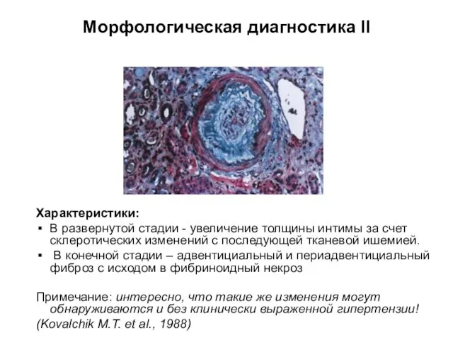Морфологическая диагностика II Характеристики: В развернутой стадии - увеличение толщины интимы