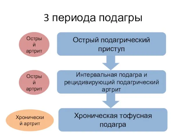 3 периода подагры Острый подагрический приступ Интервальная подагра и рецидивирующий подагрический