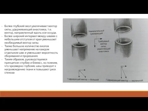 Более глубокий вкол увеличивает вектор силы, удерживающий анастомоз, т.е. вектор, направленный