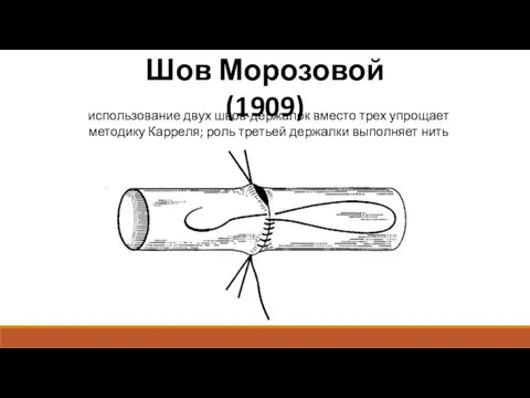 Шов Морозовой(1909) использование двух швов-держалок вместо трех упрощает методику Карреля; роль