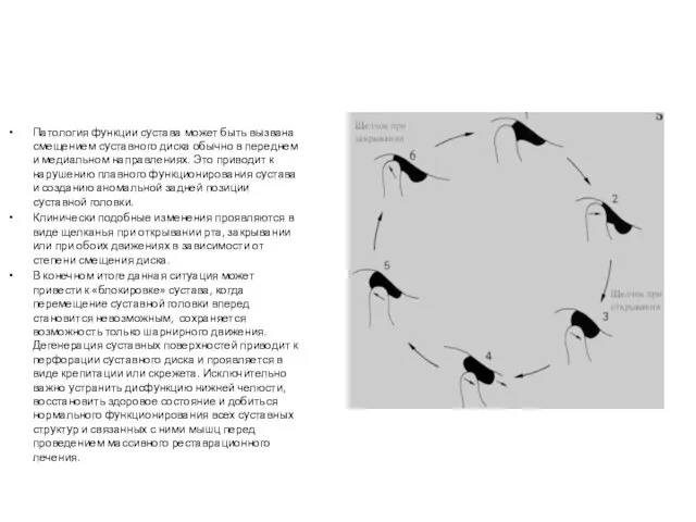Патология функции сустава может быть вызвана смещением суставного диска обычно в
