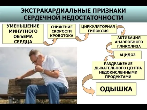 ЭКСТРАКАРДИАЛЬНЫЕ ПРИЗНАКИ СЕРДЕЧНОЙ НЕДОСТАТОЧНОСТИ УМЕНЬШЕНИЕ МИНУТНОГО ОБЪЕМА СЕРДЦА СНИЖЕНИЕ СКОРОСТИ КРОВОТОКА