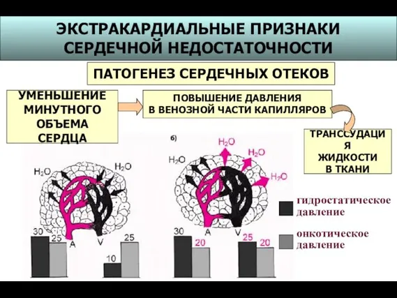 гидростатическое давление онкотическое давление ЭКСТРАКАРДИАЛЬНЫЕ ПРИЗНАКИ СЕРДЕЧНОЙ НЕДОСТАТОЧНОСТИ ПАТОГЕНЕЗ СЕРДЕЧНЫХ ОТЕКОВ