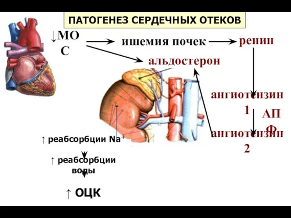 ПАТОГЕНЕЗ СЕРДЕЧНЫХ ОТЕКОВ ↓МОС ишемия почек ренин альдостерон ангиотензин 1 ангиотензин