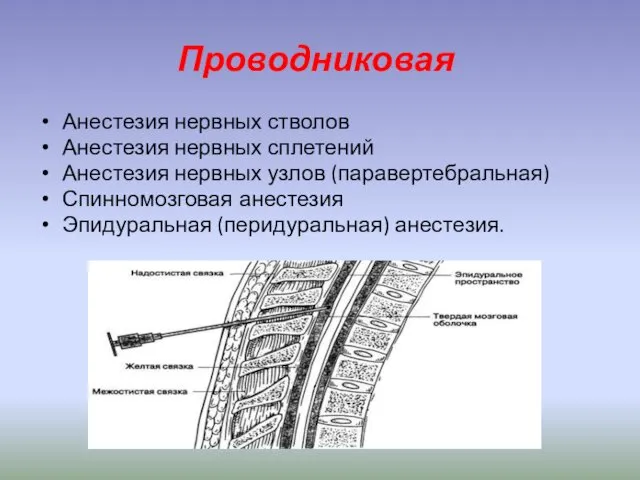 Проводниковая Анестезия нервных стволов Анестезия нервных сплетений Анестезия нервных узлов (паравертебральная) Спинномозговая анестезия Эпидуральная (перидуральная) анестезия.