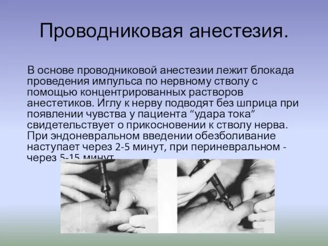 Проводниковая анестезия. В основе проводниковой анестезии лежит блокада проведения импульса по