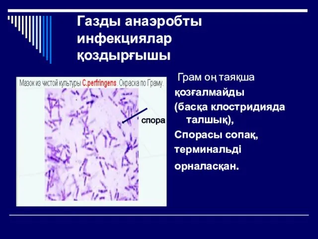 Газды анаэробты инфекциялар қоздырғышы Грам оң таяқша қозғалмайды (басқа клостридияда талшық), Спорасы сопақ, терминальді орналасқан. спора