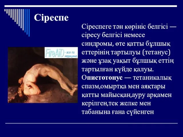 Сіреспе Сіреспеге тән көрініс белгісі —сіресу белгісі немесе синдромы, өте қатты