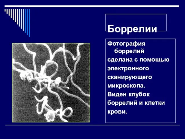 Боррелии Фотография боррелий сделана с помощью электронного сканирующего микроскопа. Виден клубок боррелий и клетки крови.