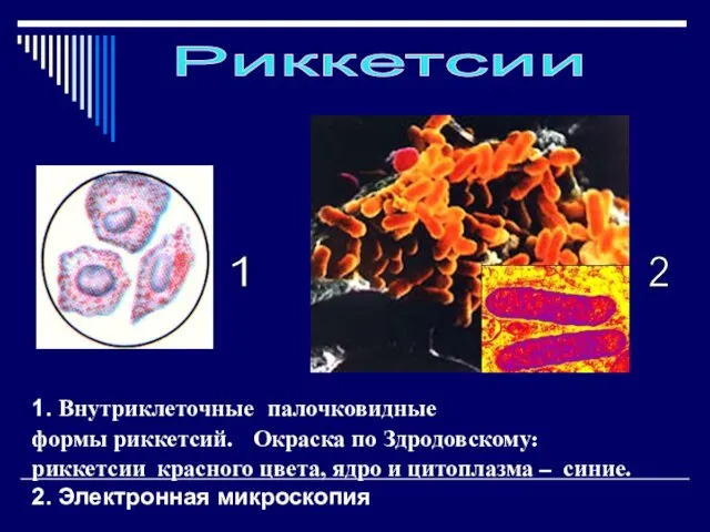 1. Внутриклеточные палочковидные формы риккетсий. Окраска по Здродовскому: риккетсии красного цвета,