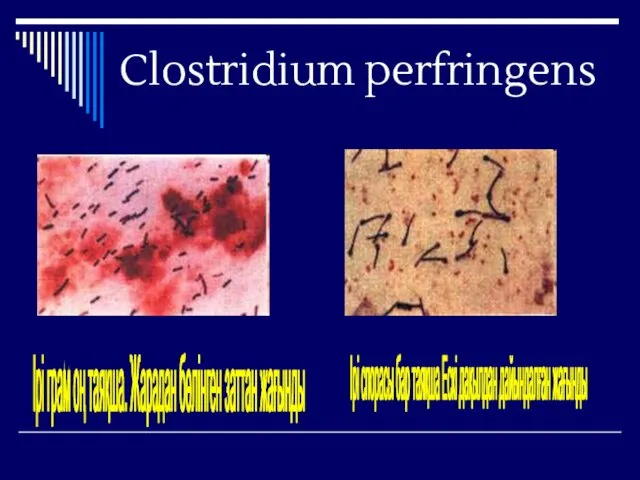 Clostridium perfringens Ірі грам оң таяқша. Жарадан бөлінген заттан жағынды Ірі