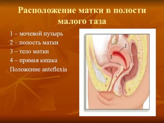 Расположение матки в полости малого таза 1 – мочевой пузырь 2