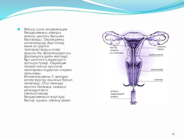 Жатыр ішіне инсеминация бағдарламасы әйелдің етеккір циклінің басынан басталады. Овуляцияны ынталандыру