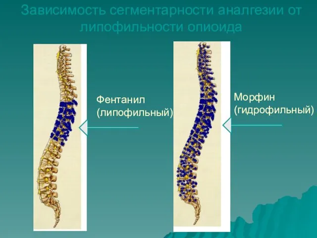 Зависимость сегментарности аналгезии от липофильности опиоида Фентанил (липофильный) Морфин (гидрофильный)