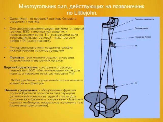 Многоугольник сил, действующих на позвоночник по Littlejohn. Одна линия - от