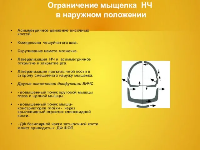 Ограничение мыщелка НЧ в наружном положении Асимметричное движение височных костей. Компрессия