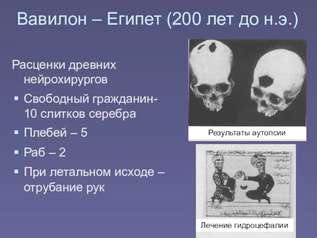 Вавилон – Египет (200 лет до н.э.) Расценки древних нейрохирургов Свободный