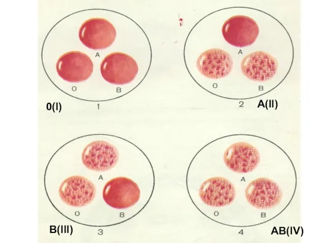 0(I) A(II) B(III) AB(IV)