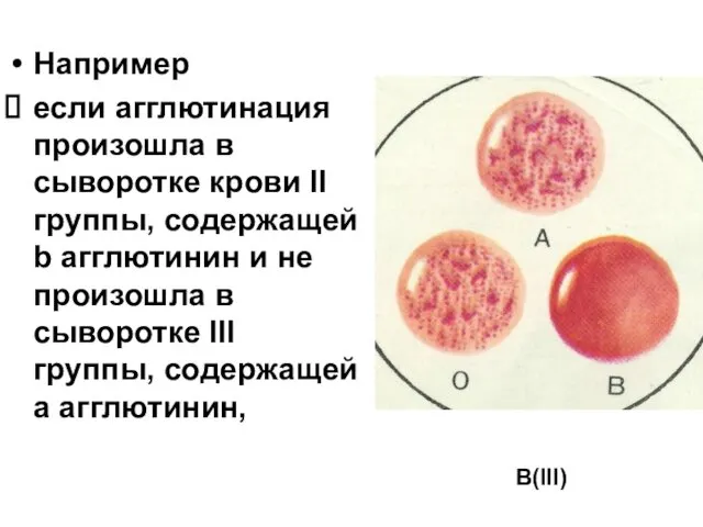 Например если агглютинация произошла в сыворотке крови II группы, содержащей b