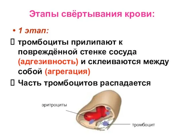 Этапы свёртывания крови: 1 этап: тромбоциты прилипают к повреждённой стенке сосуда