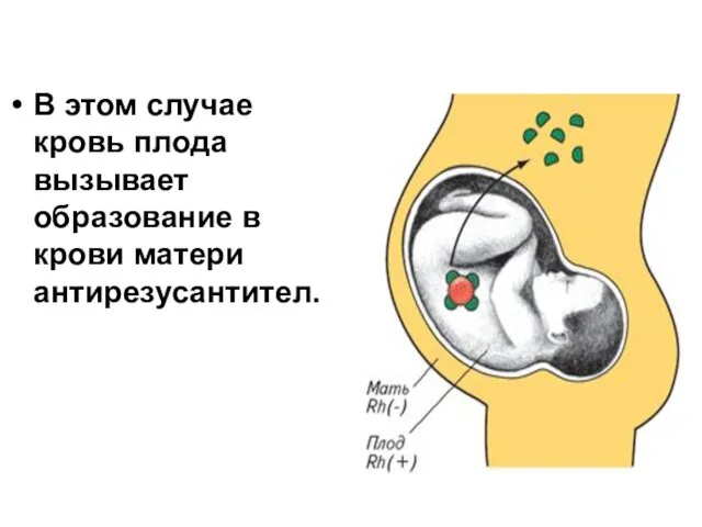 В этом случае кровь плода вызывает образование в крови матери антирезусантител.