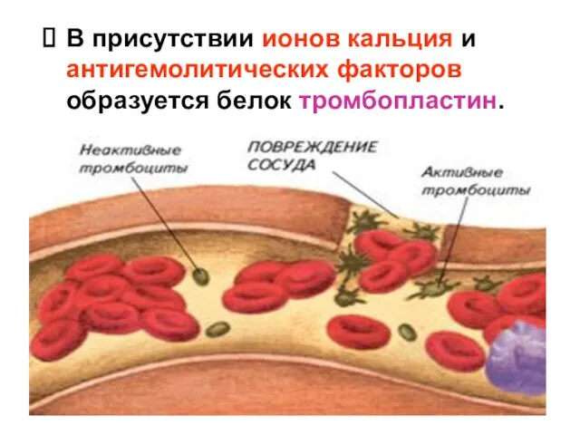 В присутствии ионов кальция и антигемолитических факторов образуется белок тромбопластин.