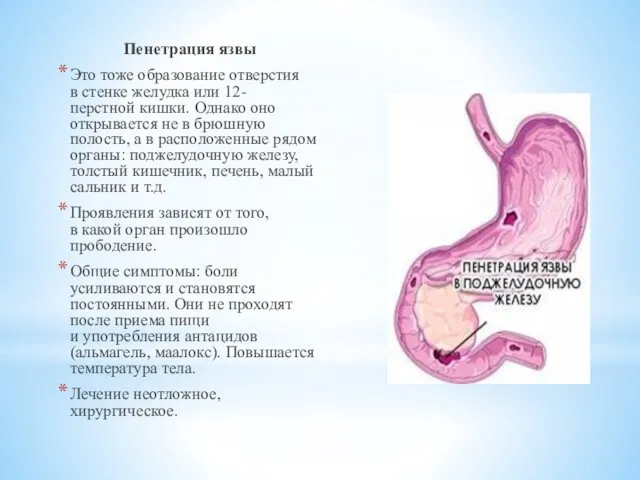 Пенетрация язвы Это тоже образование отверстия в стенке желудка или 12-перстной