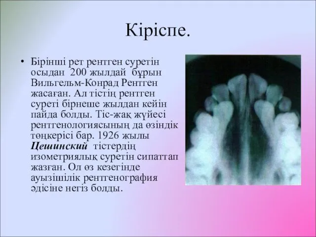 Кіріспе. Бірінші рет рентген суретін осыдан 200 жылдай бұрын Вильгельм-Конрад Рентген