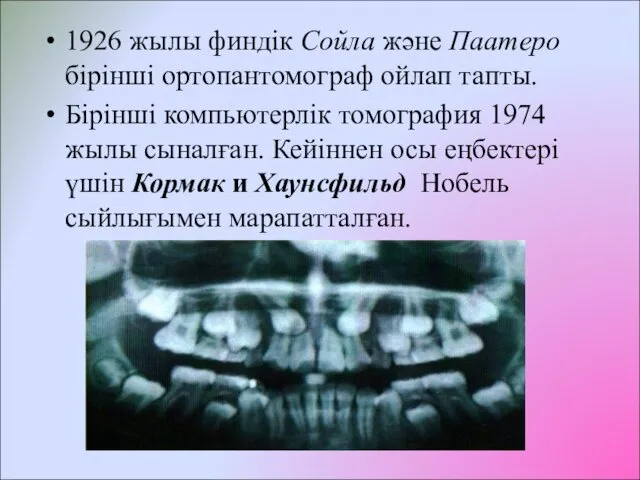 1926 жылы финдік Сойла және Паатеро бірінші ортопантомограф ойлап тапты. Бірінші