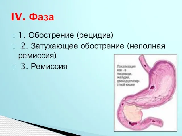 1. Обострение (рецидив) 2. Затухающее обострение (неполная ремиссия) 3. Ремиссия IV. Фаза