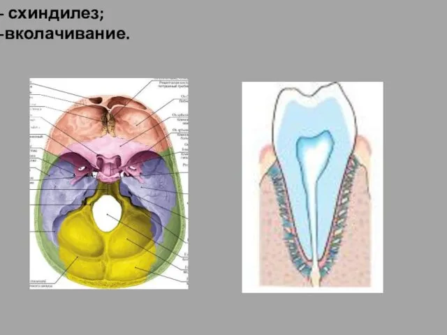 схиндилез; вколачивание.