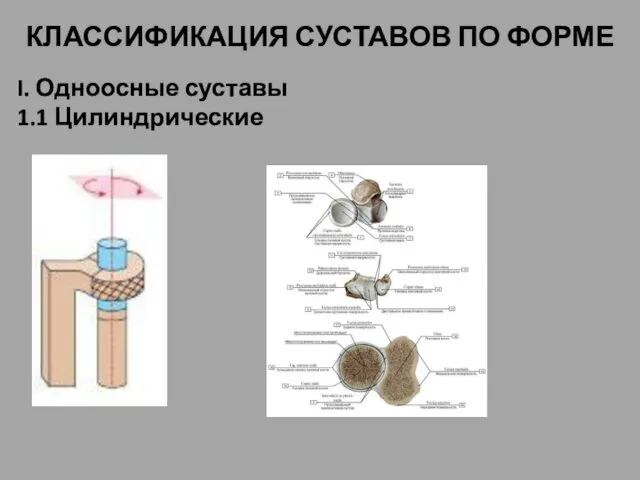 КЛАССИФИКАЦИЯ СУСТАВОВ ПО ФОРМЕ I. Одноосные суставы 1.1 Цилиндрические