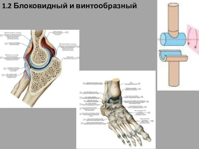 1.2 Блоковидный и винтообразный