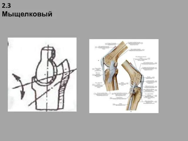 2.3 Мыщелковый