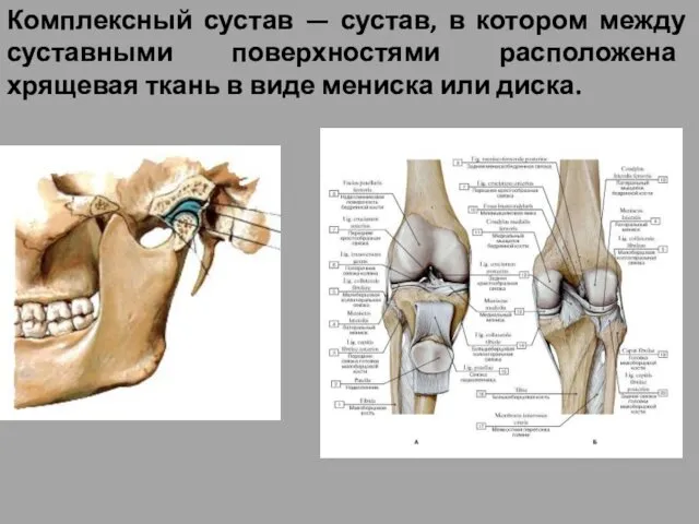 Комплексный сустав — сустав, в котором между суставными поверхностями расположена хрящевая