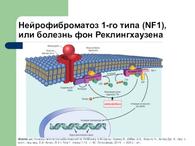 Нейрофиброматоз 1-го типа (NF1), или болезнь фон Реклингхаузена Взято из: Основы