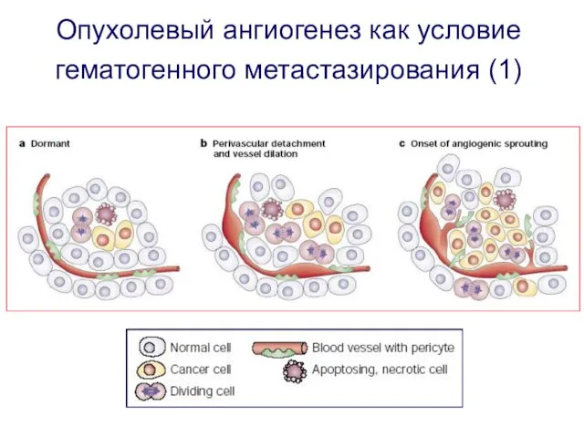 Опухолевый ангиогенез как условие гематогенного метастазирования (1)