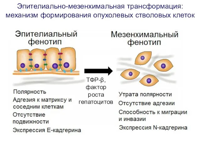 Эпителиально-мезенхимальная трансформация: механизм формирования опухолевых стволовых клеток ТФР-β, фактор роста гепатоцитов