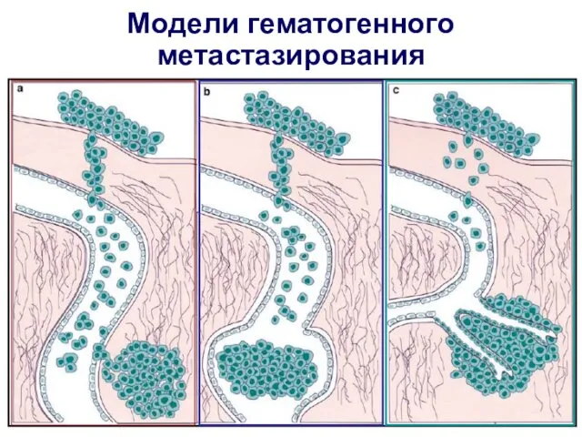 Модели гематогенного метастазирования