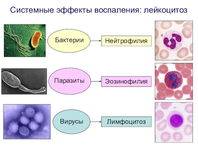 Системные эффекты воспаления: лейкоцитоз Нейтрофилия Бактерии Эозинофилия Паразиты Лимфоцитоз Вирусы